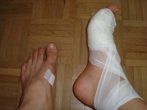 Triathlon Hofheim Verletzung Fuß